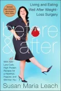 Before and After : Eating and Living Well after Weight-Loss Surgery
