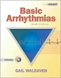 Basic Arrhythmias