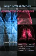 Rapid Interpretation of Ventilator Waveforms
