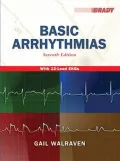 Basic Arrhythmias [With Access Code]