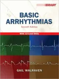 Basic Arrhythmias