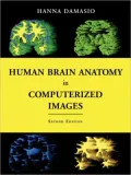 Human Brain Anatomy in Computerized Images