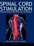 Spinal Cord Stimulation Implantation