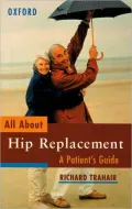 All about Hip Replacement: A Patient's Guide