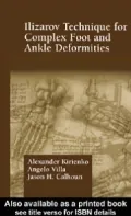 Ilizarov Technique For Complex Foot And Ankle Deformities