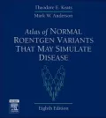 Atlas of Normal Roentgen Variants That May Simulate Disease