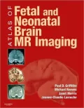 Atlas of Fetal and Postnatal Brain MR