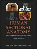 Human Sectional Anatomy: Atlas of Body Sections, CT and MRI Images