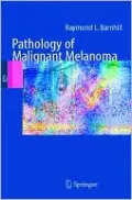 Pathology of Malignant Melanoma