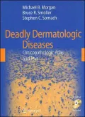 Deadly Dermatologic Diseases: Clinicopathologic Atlas and Text