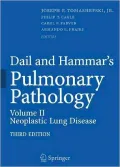 Dail and Hammar's Pulmonary Pathology: Volume II: Neoplastic Lung Disease