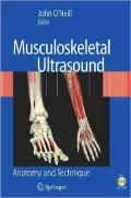 Musculoskeletal Ultrasound: Anatomy and Technique