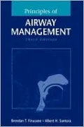 Principles of Airway Management