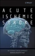 Acute Ischemic Stroke: An Evidence-Based Approach