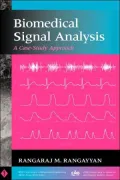 Biomedical Signal Analysis