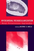 Myocardial Revascularization : Novel Percutaneous Approaches