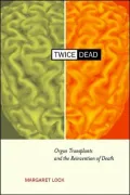 Twice Dead: Organ Transplants and the Reinvention of Death