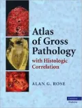 Atlas of Gross Pathology: With Histologic Correlation