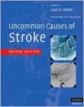 Uncommon Causes of Stroke