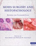 Mohs Surgery and Histopathology: Beyond the Fundamentals