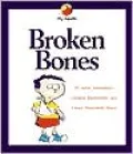 Broken Bones