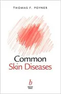 Common Skin Diseases