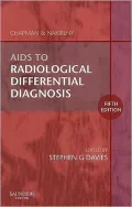 Aids to Radiological Differential Diagnosis