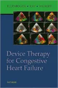 Device Therapy for Congestive Heart Failure