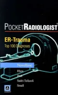 ER Trauma : Top 100 Diagnoses