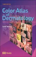 Color Atlas of Dermatology