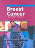 Breast Cancer