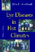 Eye Diseases in Hot Climates
