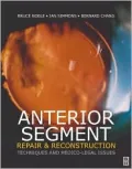 Anterior Segment Repair and Reconstruction: Technical and Medico-Legal Issues