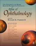 The University of Miami Bascom Palmer Eye Institute atlas of ophthalmology
