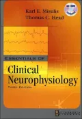 Essentials of Clinical Neurophysiology