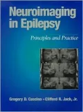 Neuroimaging in Epilepsy : Principles and Practice