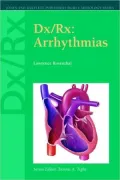 Arrhythmias