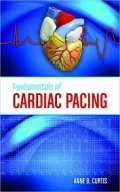 Fundamentals of Cardiac Pacing