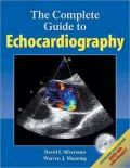 The Complete Guide To Echocardiography