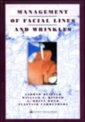 Management of Facial Lines and Wrinkles