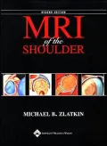 MRI of the Shoulder