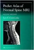 Pocket Atlas of Normal Spine MRI