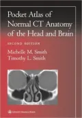 Pocket Atlas of Normal CT Anatomy of the Head and Brain