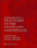 Fractures of the Pelvis and Acetabulum