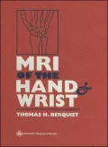 MRI of the Hand and Wrist