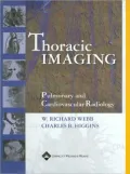 Thoracic Imaging: Pulmonary and Cardiovascular radiology