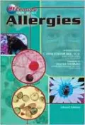 Allergies