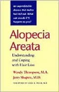 Alopecia Areata: Understanding and Coping with Hair Loss