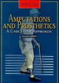 Amputations and Prosthetics: A Case Study Approach