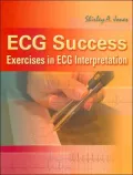 ECG Success: Exercises in ECG Interpretation